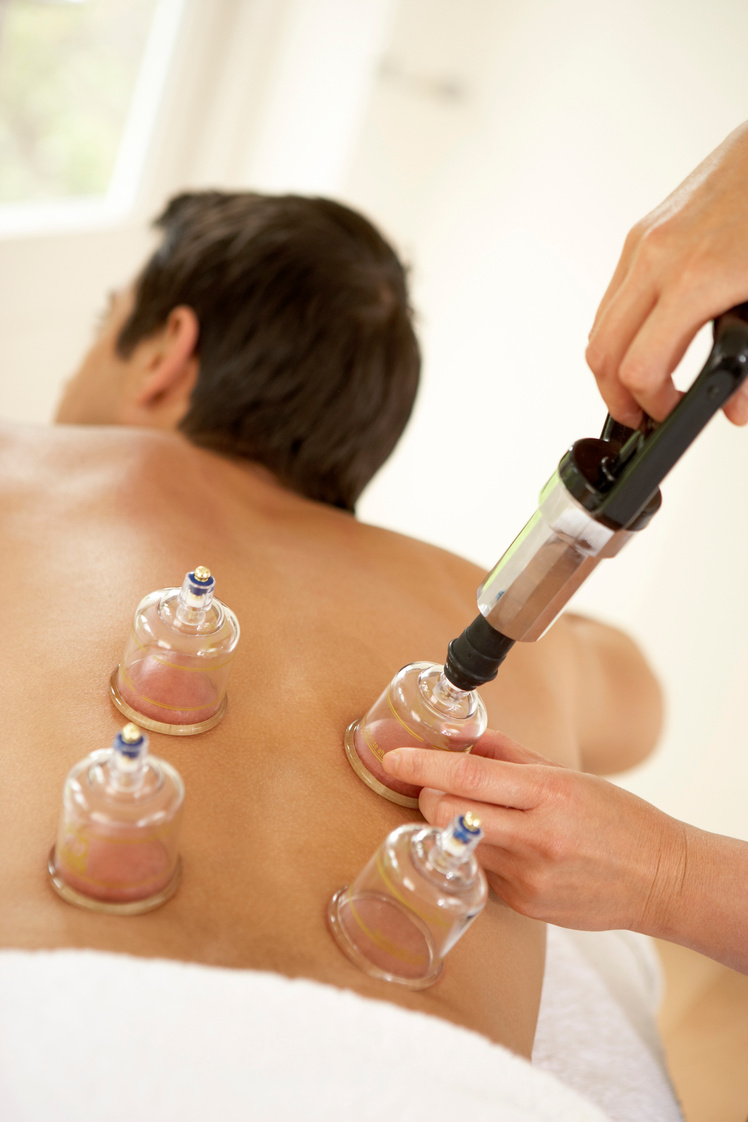 Man receiving cupping therapy